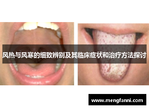 风热与风寒的细致辨别及其临床症状和治疗方法探讨